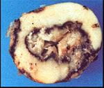 black leg soft rot