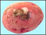 Early blight of potatoes